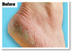 O'Keeffes Healthy Feet Foot Cream - 91g - Foot Care at MySupplementShop by O'Keeffes